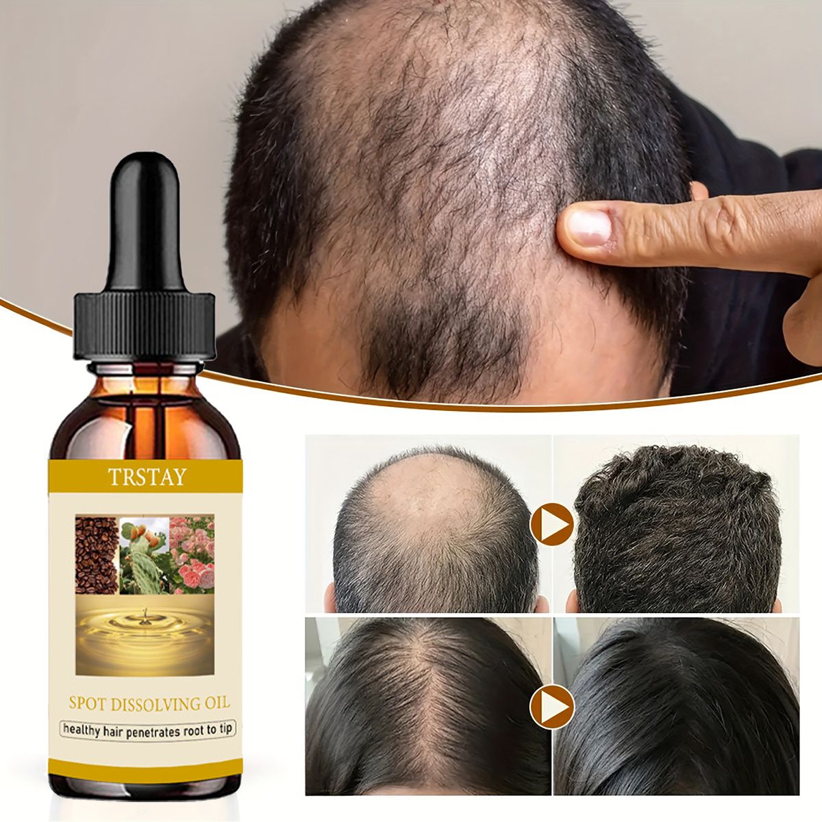 50ML sakal uzatma yağ Anti alo - Beard Oil incelemesi ve fiyatı